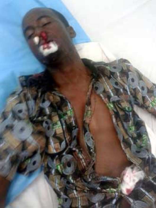 Mohammed Shuaibu, unconscious in hospital bed.