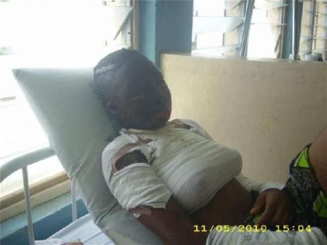 Franka Ogbuh: Acid Bath Victim 