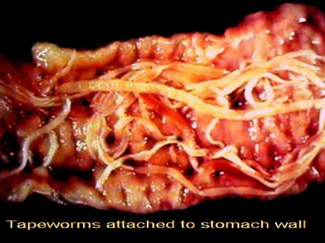 <b>Tapeworm attached to stomach wall</b>