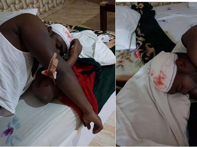 Pictures of the illegal raid on Rochas relatives injuring his nephew Onyedi Okorocha by security personnel under the order of Governor Emeka Ihedioha 